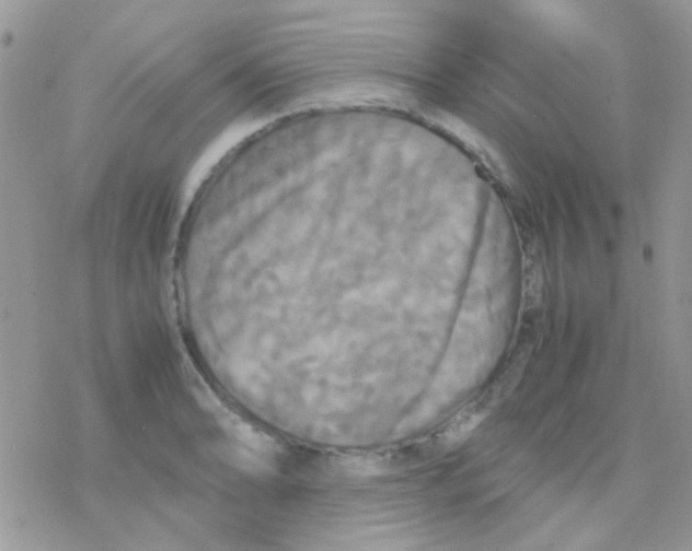 X0000077361086200611171917