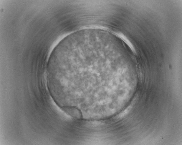 X0000077361100200611171917