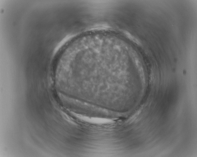 X0000077361400200611171911