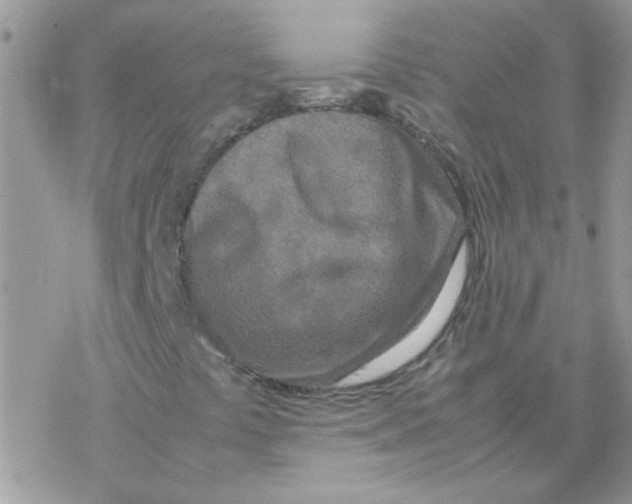 X0000077361441200611171911