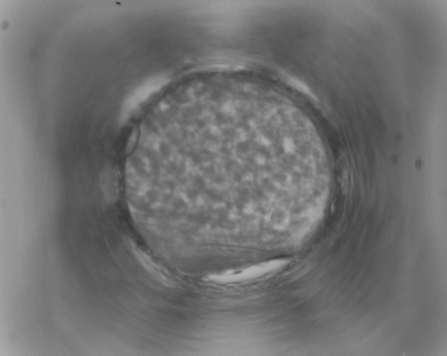 X0000077361448200611171911