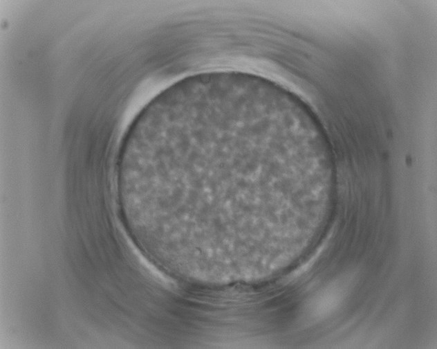 X0000077361517200611171910