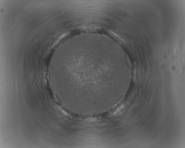 X0000077381010200611031931