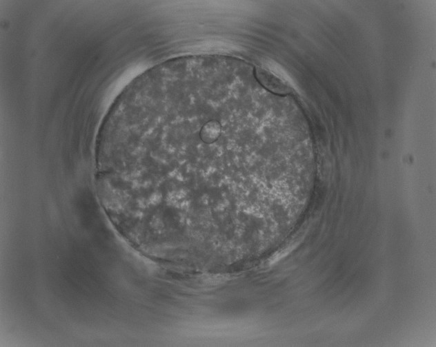 X0000077381087200611031930