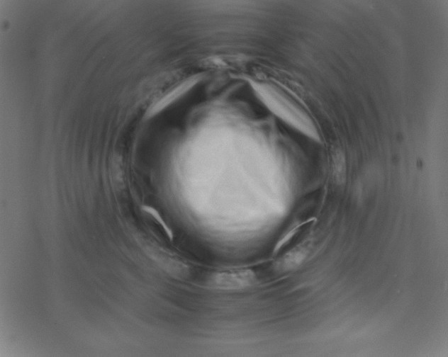 X0000077380571200611101732