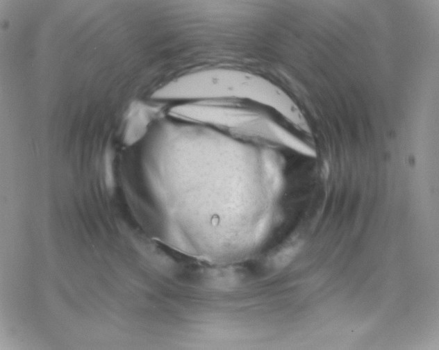 X0000077380524200611172017