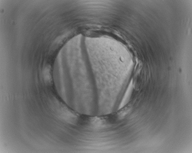 X0000077380616200611172015