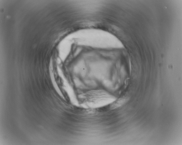 X0000077380624200611172015