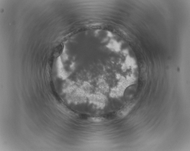 X0000077380654200611172015