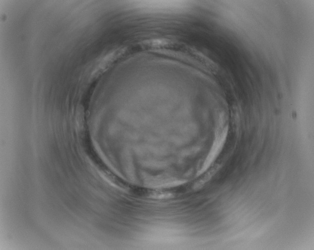 X0000077380760200611172014