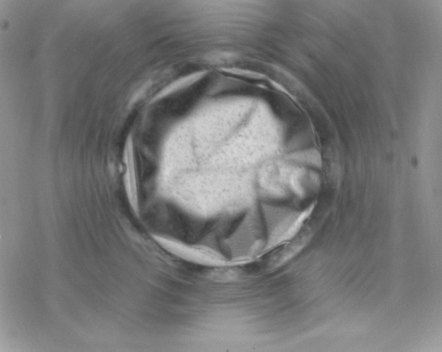 X0000077380762200611172014