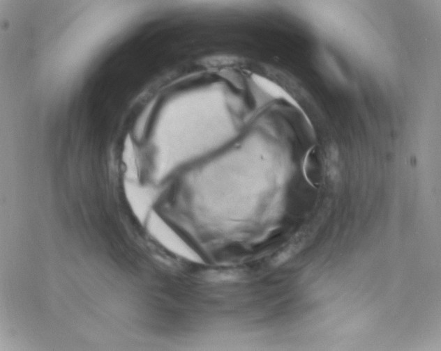 X0000077380763200611172014