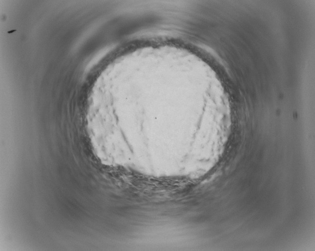 X0000077380871200611172011