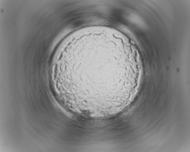 X0000077381235200611172006