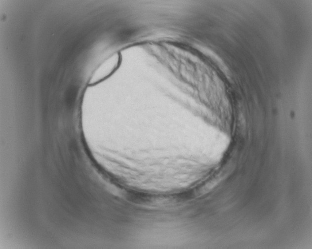 X0000077381375200611172003