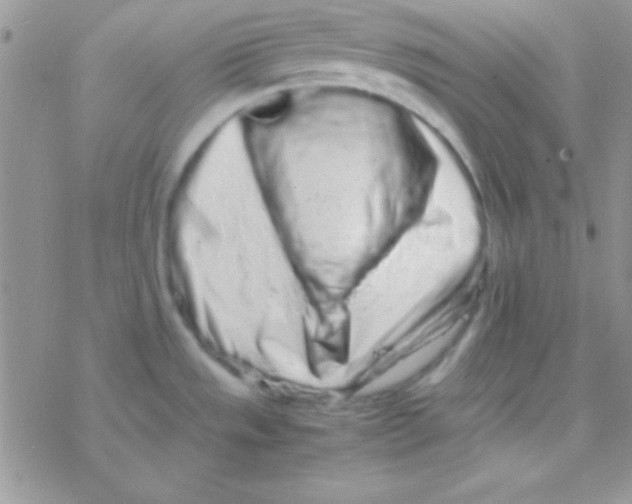 X0000077381533200611172001