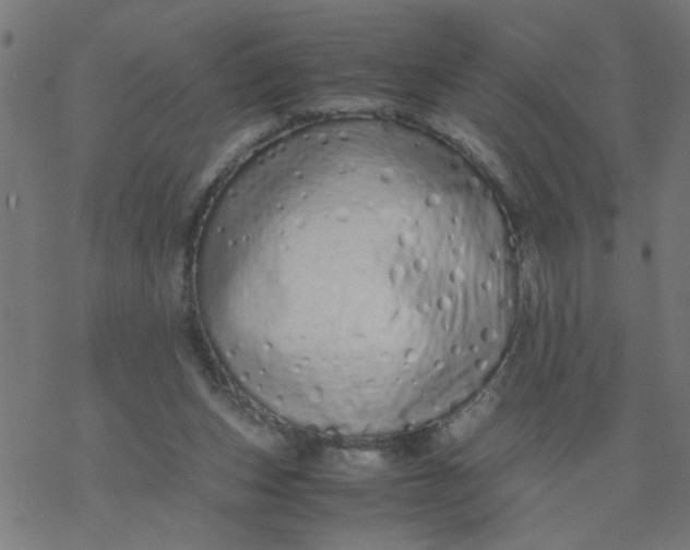 X0000077390159200611032010