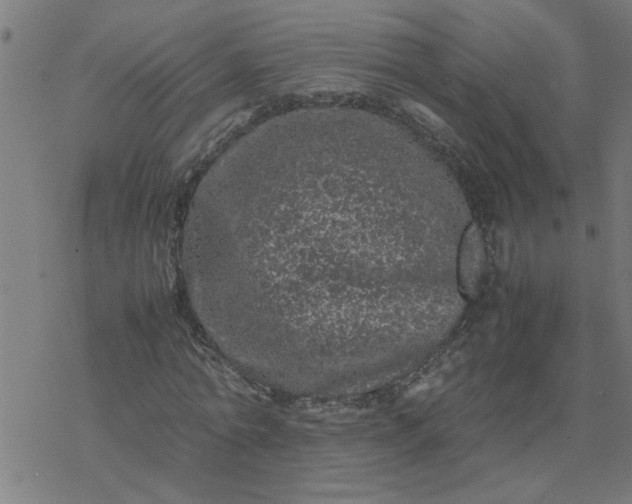 X0000077390774200611032000