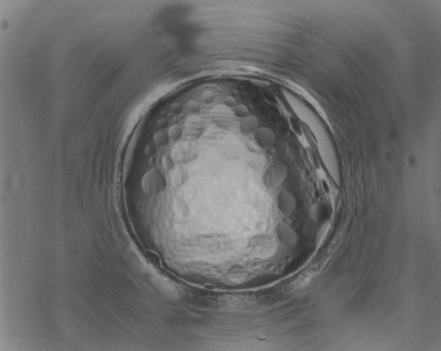 X0000077391379200611031951