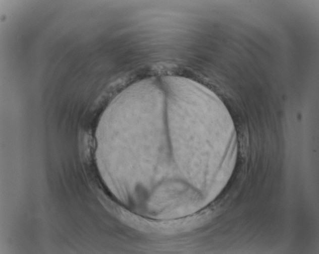 X0000077390038200611101805