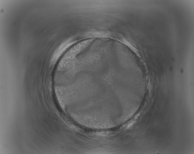 X0000077390103200611101804