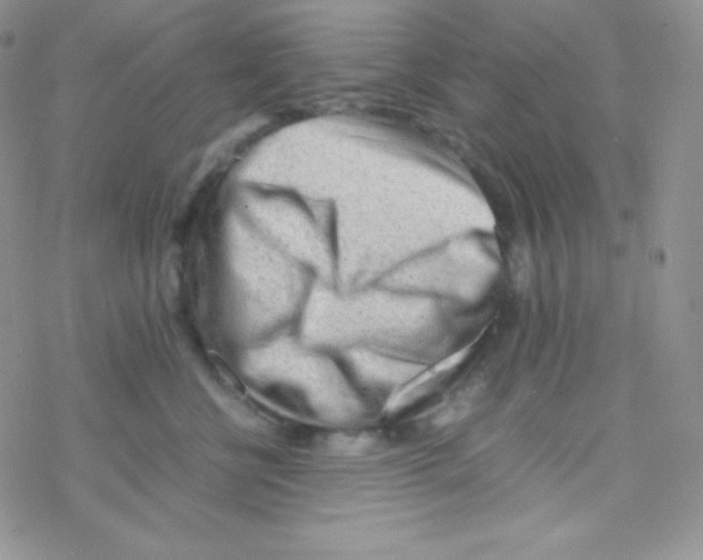 X0000077390570200611172042