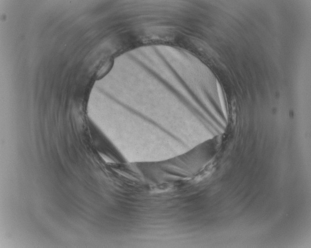 X0000077390915200611172035