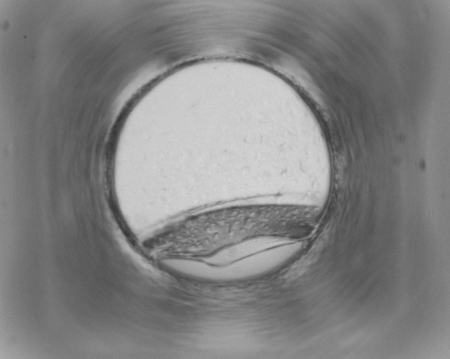 X0000077390991200611172034