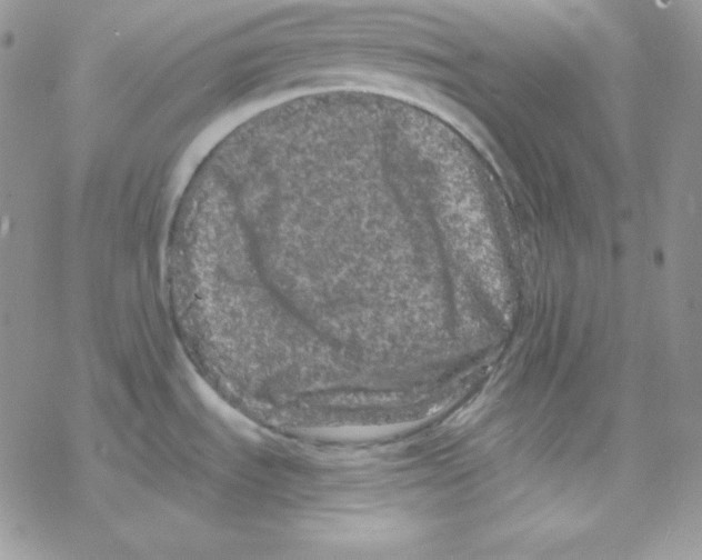 X0000077391535200611172026