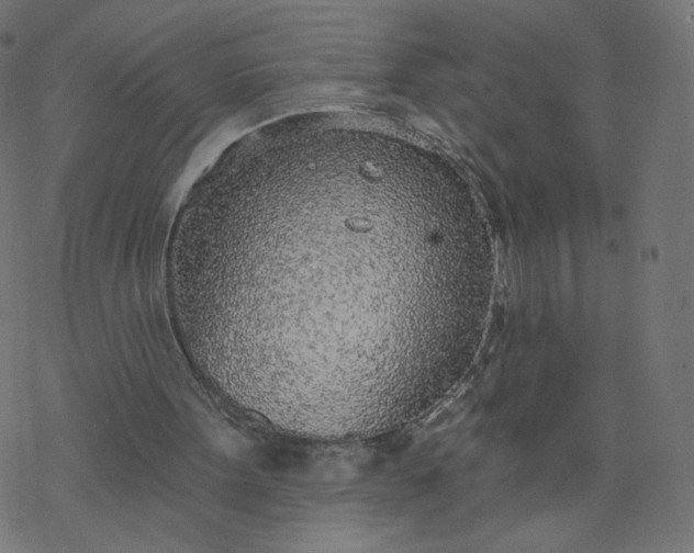 X0000077400099200611032036