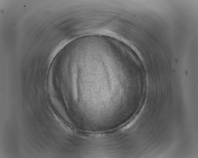 X0000077401529200611032014