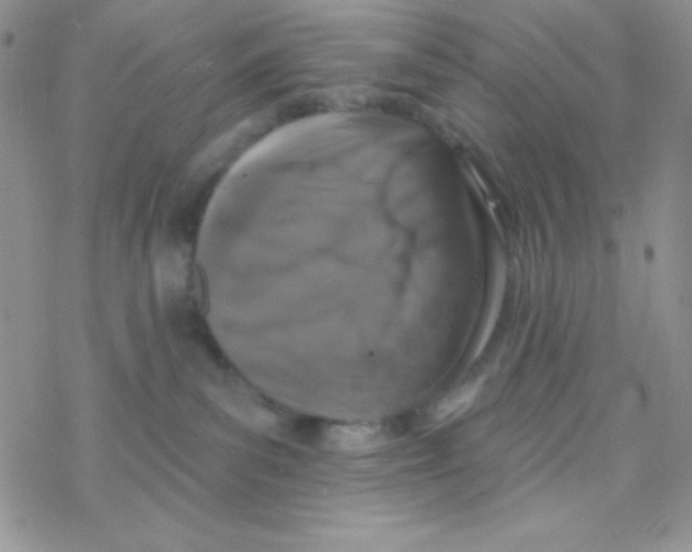 X0000077400139200611172113