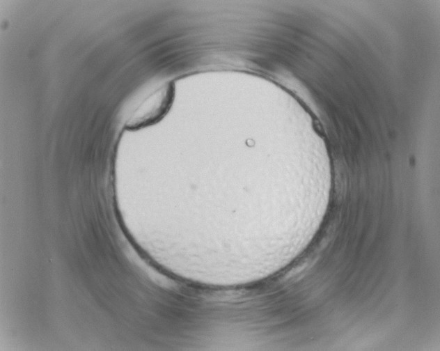 X0000077401387200611172053