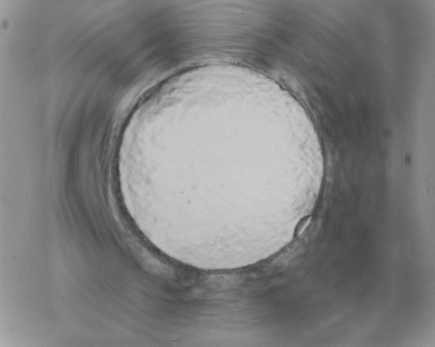 X0000077410145200611172138