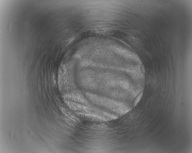 X0000077981106200611171721