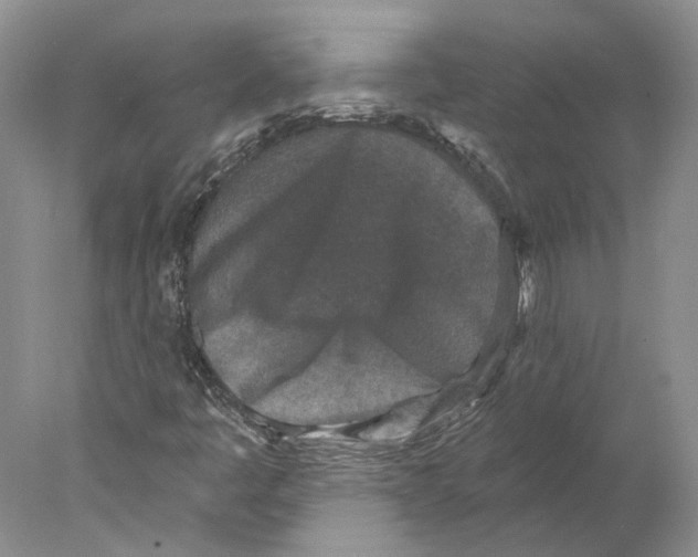 X0000077981445200611251333
