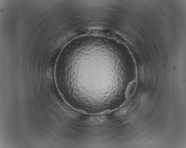 X0000077990571200611031423