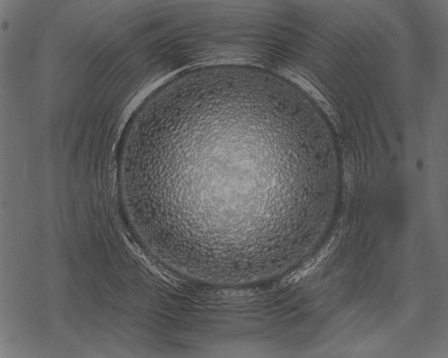 X0000077990933200611031417