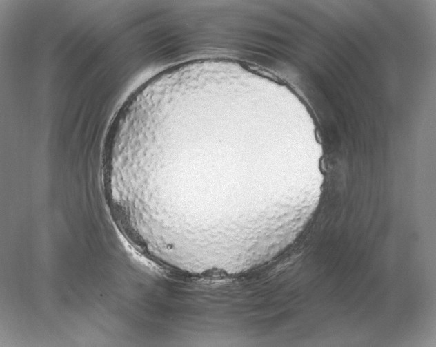X0000077991143200611251404