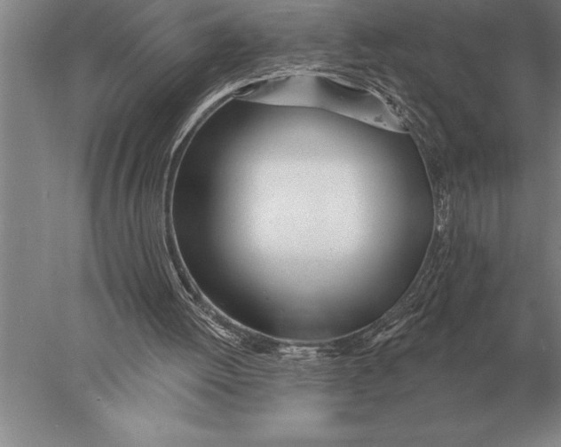 X0000078010052200611171857