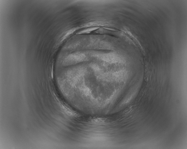 X0000078010062200611171857