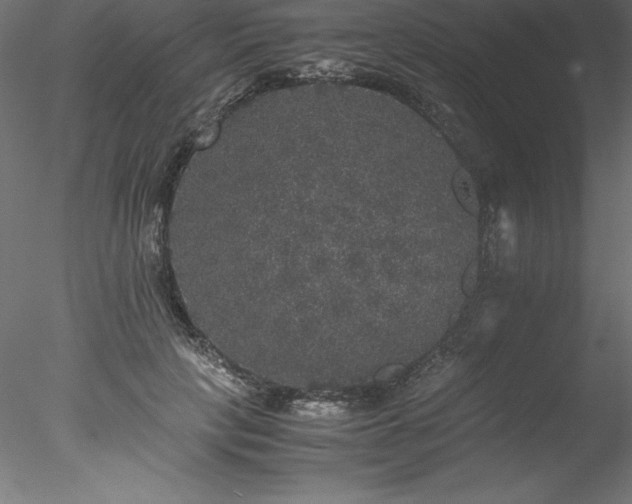 X0000078020649200611031457