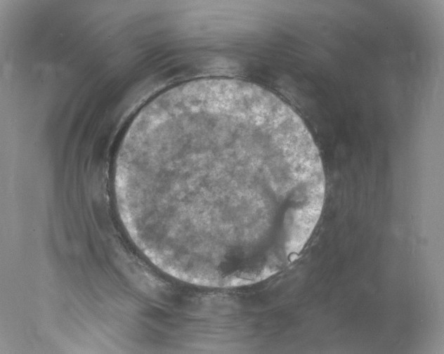 X0000078020146200611171922