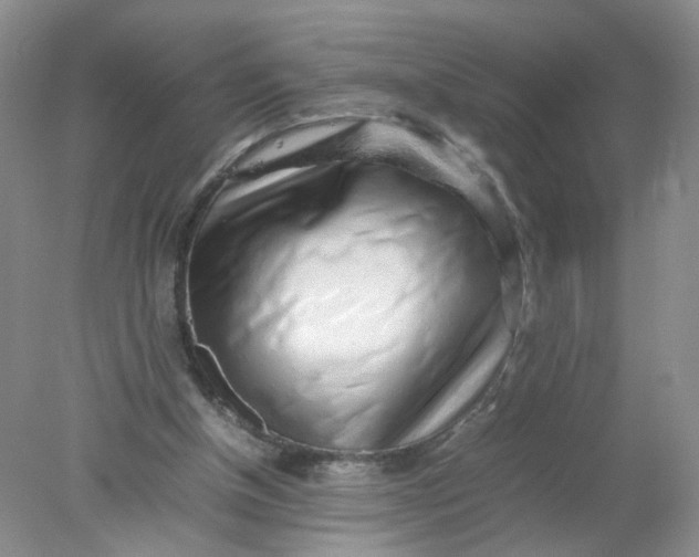 X0000078020154200611171922