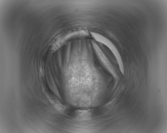 X0000078030170200611171948