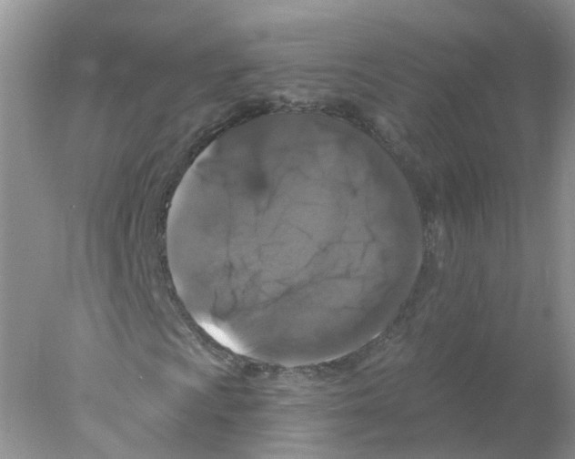 X0000078031009200611251550