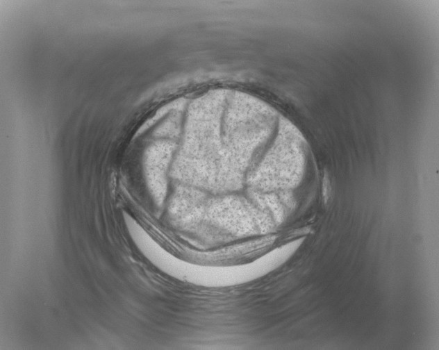 X0000078031492200611251542