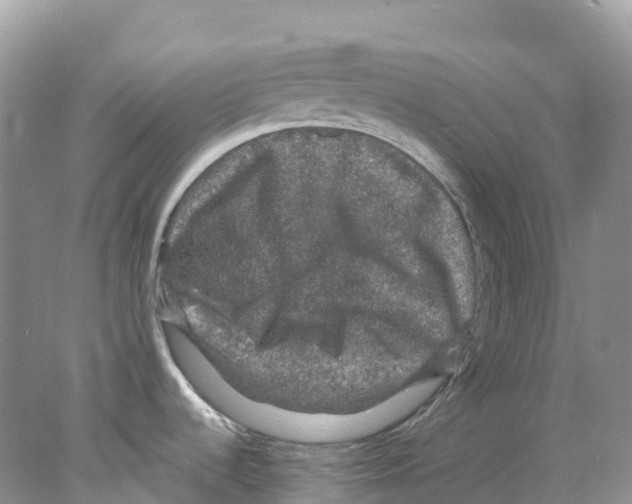 X0000078031536200611251542