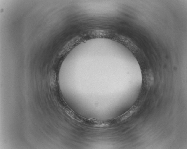 X0000078240760200611251238