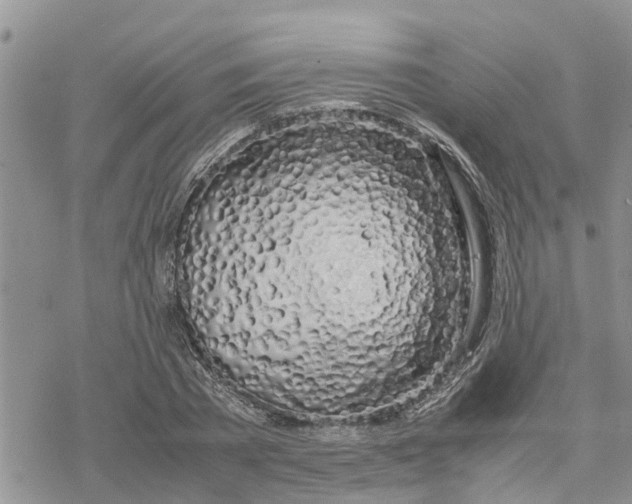 X0000078240785200611251238